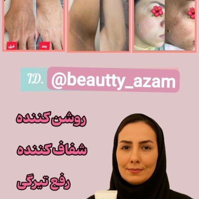 کانال روبیکا ارایشی درمانی Beautty_azam